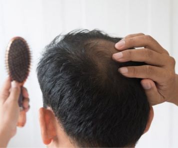 hair loss treatment in bhubaneswat