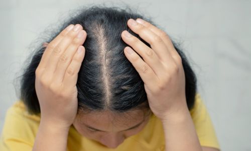 female hair loss treatment in bhubaneswar